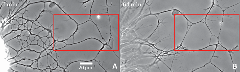 Axon zippering and its control by tension forces - fig2 annot crop