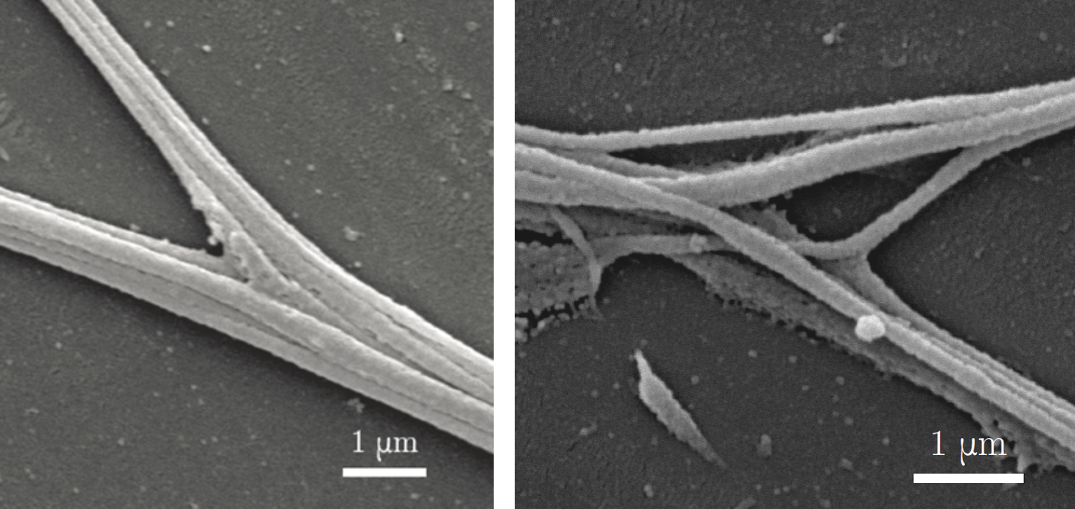 Axon zippering and its control by tension forces - group 42