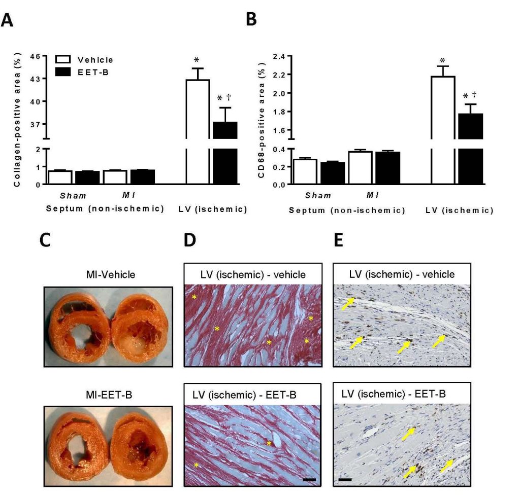 A promising pharmacological approach in cardiovascular disease prevention - obr neckar vyb