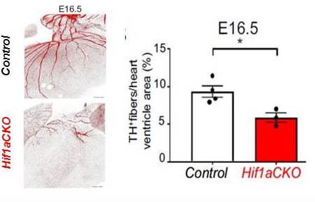 Transcription factor Hif-1a is required for the correct development of the sympathetic nervous system and innervation of the heart - kolar