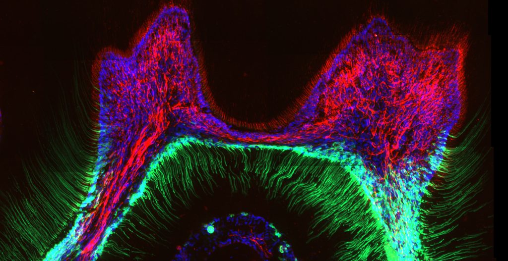 Clove oil alleviates cold-induced toothache by blocking the TRPC5 ion channel - vlachova obr