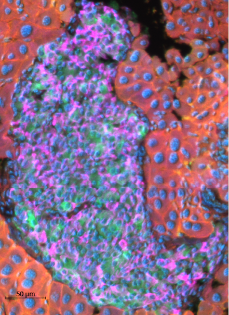 Mouse pancreatic islets surrounded by exocrine tissue, nuclei (blue), Cre recombinase activity in beta cells (blue), beta cells without Cre recombinase aktivity (pink).