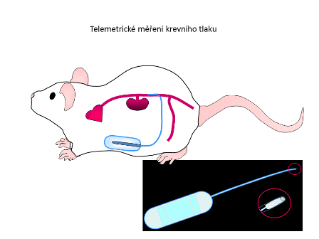 Telemetric monitoring of blood pressure - bez nazvu