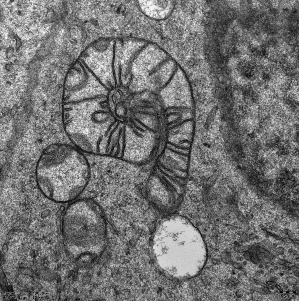 MitoŠnek – nejlepší fotografie v soutěži Věda Fotogenická r. 2017, kategorie On-line hlasování