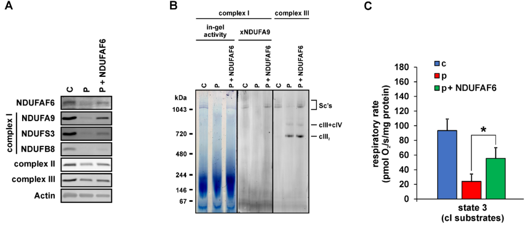 Mitochondriální dysfunkce a Fanconiho syndrom - fanconi2