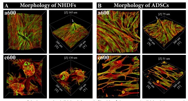 Nanocelulóza jako perspektivní nosič buněk pro aplikace v regenerativní medicíně - nanoceluloza