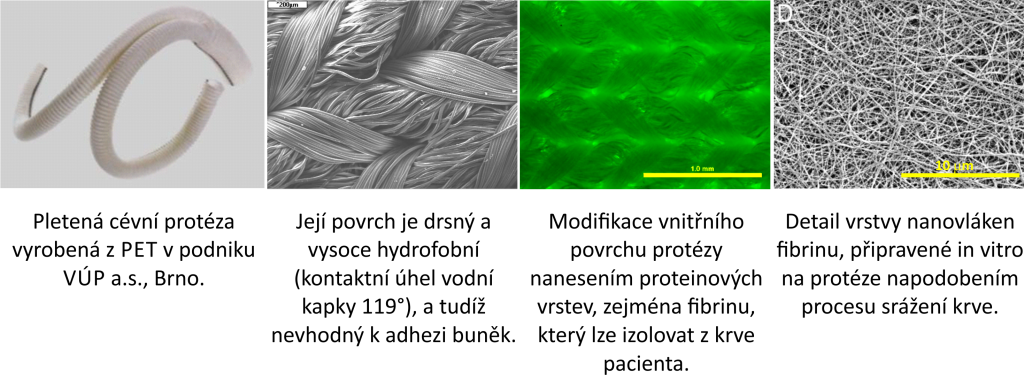 Biomateriály a tkáňové inženýrství - 1 endotel cevni protezy