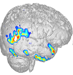 Development of new diagnostic techniques of epilepsy - 2014 03 19 22 01 251