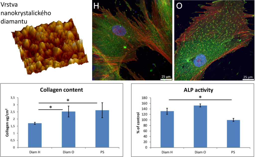 Biomateriály a tkáňové inženýrství - 3 nanokrystalicky diamant 1