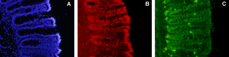 Bowel functionality of the newborn is influenced also by the mother's timing system -