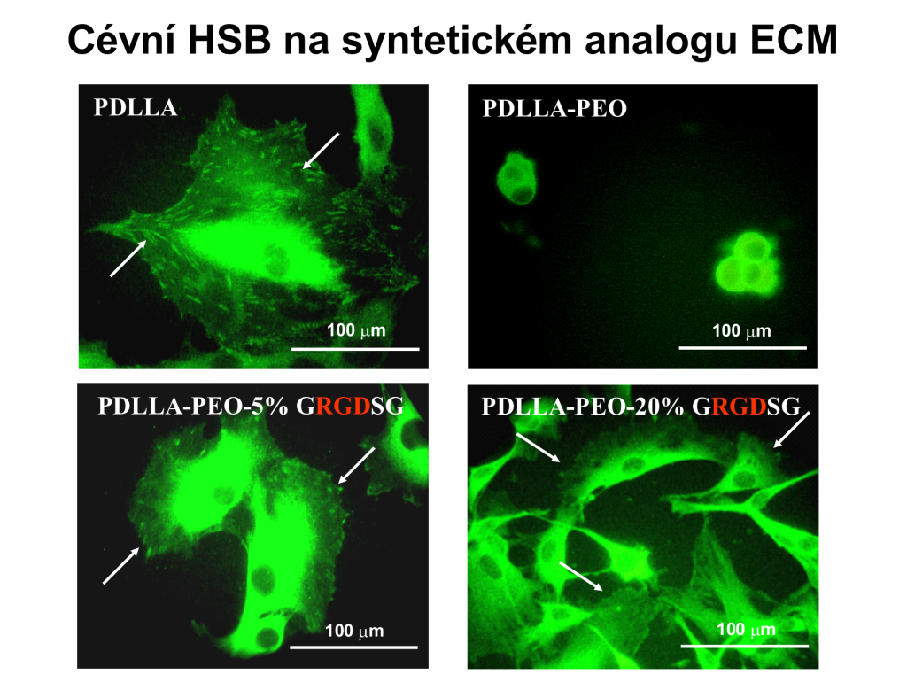 Vytváření zcela nových tkáňových náhrad - cevni hsb