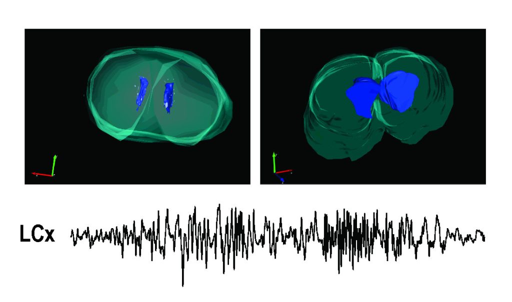 Impact of seizures on the developing brain - fig 2