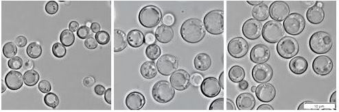 Transporters of pathogenic yeasts and lipid composition of their membranes as targets for new antifungal drugs - maruska bunky