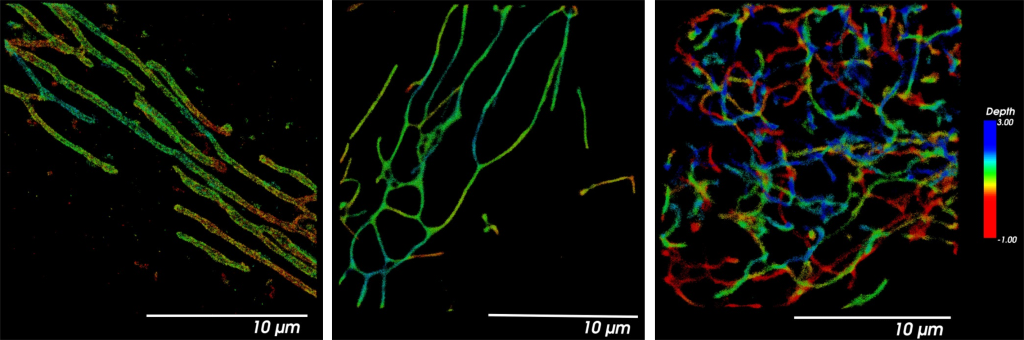 Studium specifit mitochondriálního metabolismu u rakovinných buněk - morfologie