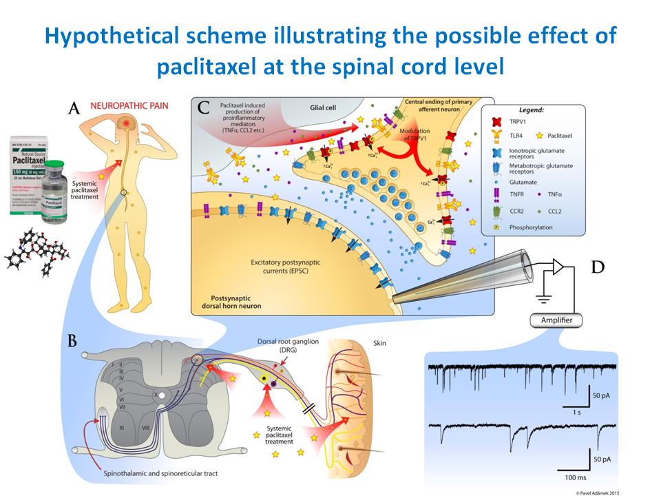 Chemotherapy induced neuropathic pain - neuro bolest 1