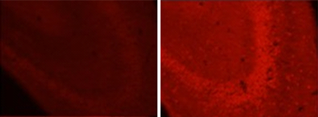 The role of oxidative stress in pathogenesis of epilepsy and seizures in immature brain - ox stres