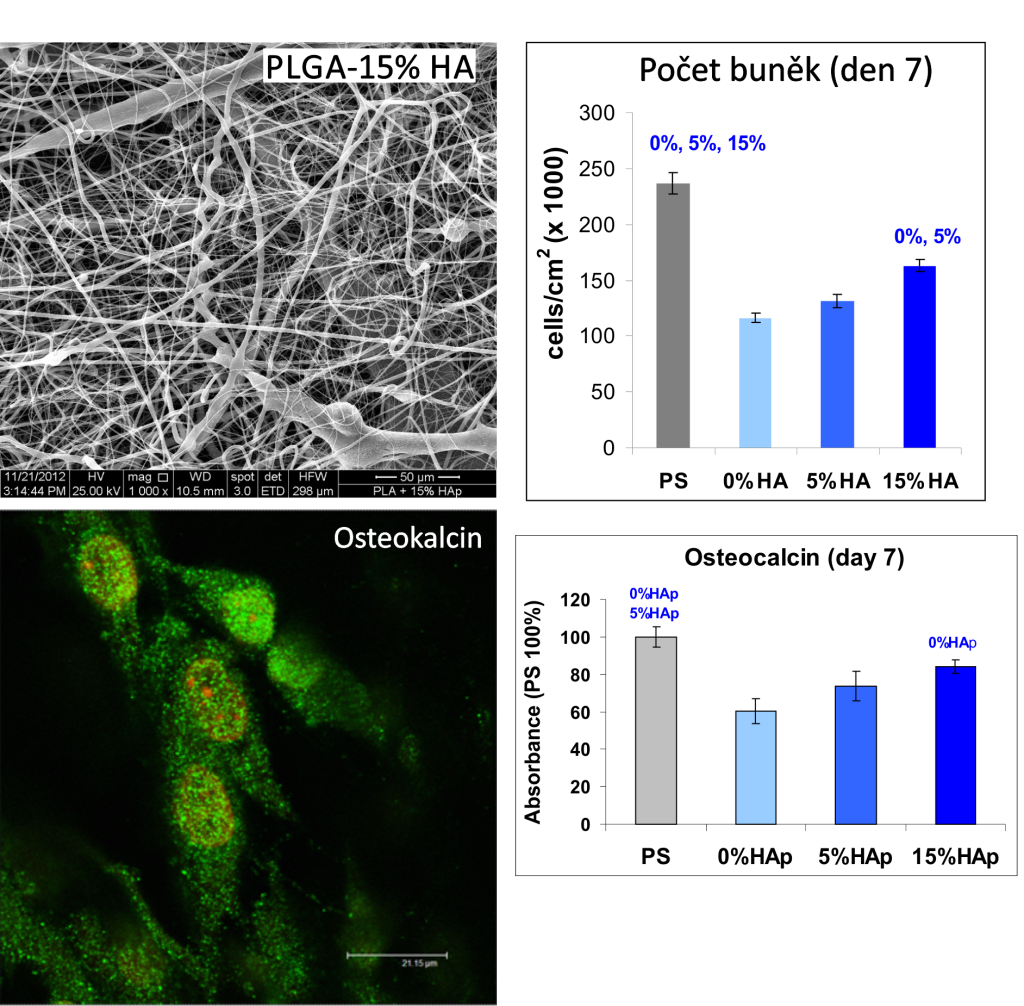 Vytváření zcela nových tkáňových náhrad - potencialni nahrady kostni tkane 3