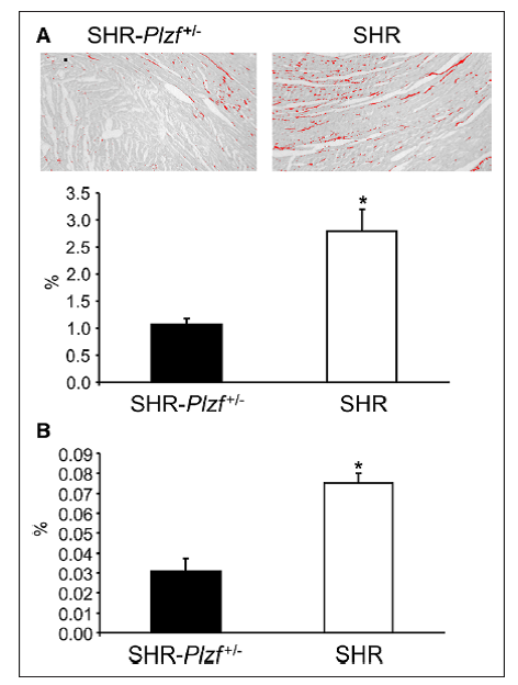 Role of Plzf gene in regulation of metabolic and cardiac traits - pravenec