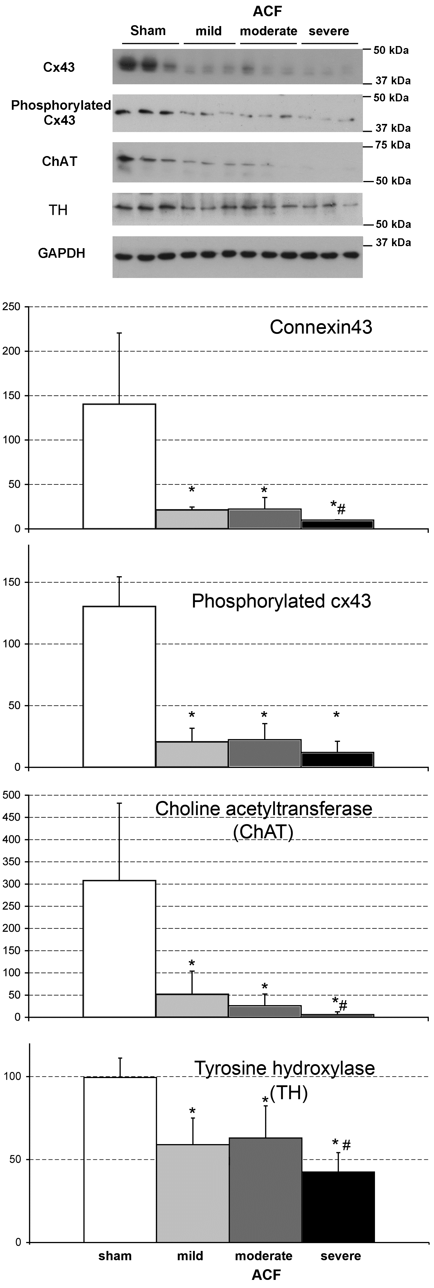 Fyziologické a molekulární změny během progrese srdečního selhání - vm3 fig4 wb densitometry final