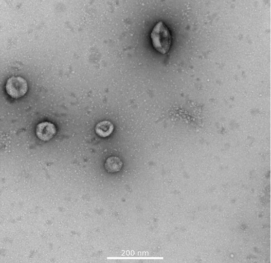 Signaling role of pancreatic β-cell exosomes - 073 2 1