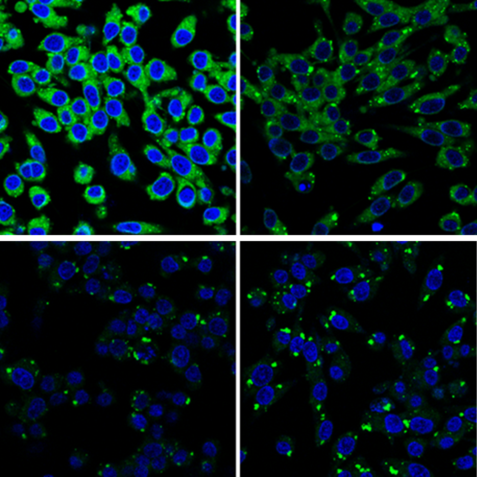 Úloha redoxní signalizace v metabolismu lipidů v β-buňkách - 073 3