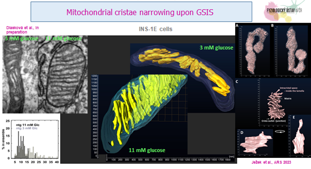 Mitochondrial ultramorphology - 075 211