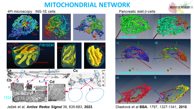 Mitochondrial ultramorphology - 075 212