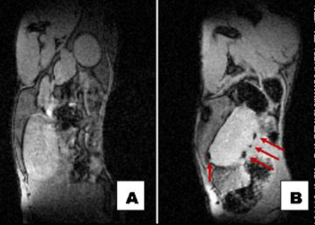 Development of GLP-1-conjugated nanoparticles for β-cell magnetic resonance imaging - 075 31